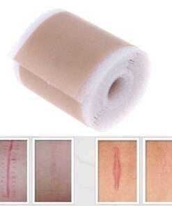 Scar Removal Silicone Gel Self-Adhesive Silicone Gel Tape Patch for Acne Burn Scar Reduce